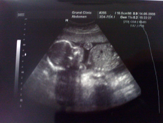21 неделя беременности фото ребенка в животе